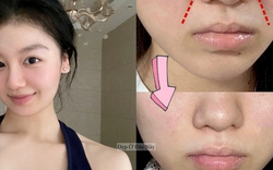 Trẻ hơn 5 tuổi nhờ 5 mẹo cải thiện rãnh cười đơn giản tại nhà