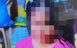 Bé gái 12 tuổi tử vong sau khi bị phạt gập bụng 100 cái vì đi học muộn