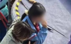 Nữ sinh bị bắn tên trúng mặt trong hội thi thể thao của trường