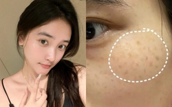 Không cần mỹ phẩm ngoại, đây là 5 kem dưỡng "made in Vietnam" làm mờ thâm, sáng da cực đỉnh