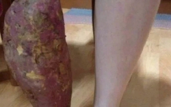 Bức ảnh làm 50 triệu người bật cười, nhưng lại khiến mẹ tôi khóc nức nở