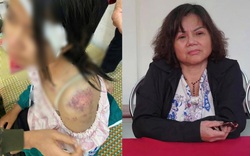 Hoàn cảnh cháu bé bị bà nội và 2 người đàn ông bạo hành: Bố mẹ ly hôn khi mới 1 tuổi, kể bị đánh 4 tiếng