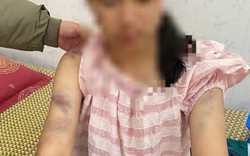 Mẹ bé gái bị bạo hành ở Thái Nguyên: Con bị đánh suốt 4 tiếng, dọa rút móng tay