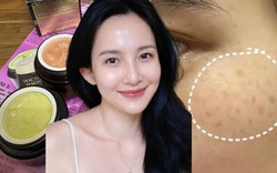 Kem trị nám trôi nổi đang phá hủy da nhiều người mua “nhẹ dạ”