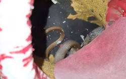 Nhìn vào trong giày, người phụ nữ sốc nặng khi thấy thứ đáng sợ