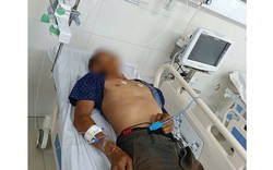 Ngộ độc sau khi ăn bọ xít, một bệnh nhân nguy kịch