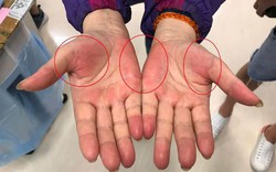 Nếu thường xuyên có 7 cảm giác này, rất có thể nhiều bệnh ung thư đang "thách thức", bạn cần đi khám ngay!