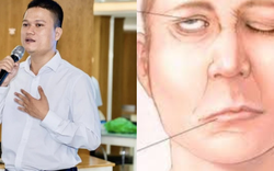 Nhà sáng lập thương hiệu Cà Mèn qua đời ở tuổi 34 vì đột quỵ: Căn bệnh tăng cao khi trời lạnh, có 4 dấu hiệu nhận biết sớm nhiều người bỏ qua
