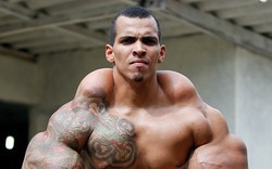 Chàng trai bắp tay to cuồn cuộn cực kinh dị, mê thể hình mà suýt mất mạng, đừng dại mà làm theo