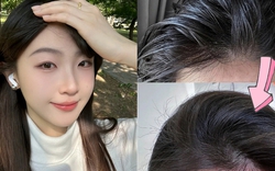 Mưa gió tóc bết, da đầu ngứa? 5 mẹo cực hay giúp tóc sạch bồng bềnh cả ngày!