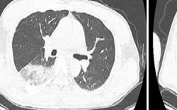 Người đàn ông bệnh nặng vì thích chơi chim