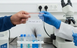 Bị trêu 'bé không giống bố', người đàn ông bí mật mang tóc con xét nghiệm ADN