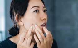 Cứ đổ lỗi cho stress, ai ngờ nguyên nhân mệt mỏi, da xấu, tóc rụng là do thiếu dưỡng chất này: 8 dấu hiệu phụ nữ rất dễ gặp