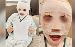 Vợ đang ngủ bị chồng tạt nước sôi vào mặt để huỷ dung vì sợ "gặp người đàn ông khác"