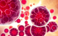 Nhiễm trùng nấm khiến 1 người nguy kịch và 18 ca mắc bệnh