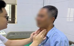 Vỡ mủ nang tuyến giáp do sờ nắn sai cách