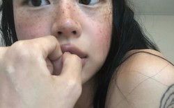 Cảnh báo: Nữ giới có 4 vùng này trên cơ thể càng "đen" chứng tỏ tử cung càng chất nhiều độc tố