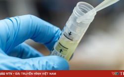 Infographic: Bệnh lây truyền qua đường tình dục có những dấu hiệu nào?