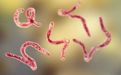 Sụt cân kéo dài vì nhiễm cả ổ giun tóc