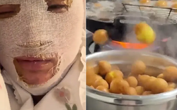 Cô gái suýt biến dạng khuôn mặt khi nấu ăn, cảnh báo 3 thực phẩm dễ "phát nổ" cần chú ý