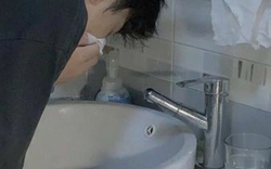 Ngực nam sinh 17 tuổi "phát triển" như nữ giới vì tự ý dùng thuốc trị mụn