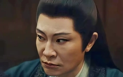 Mỹ nam biến dạng gương mặt vì thẩm mỹ