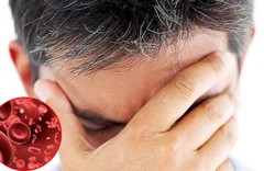 Tóc bạc sớm có phải do "máu xấu"?