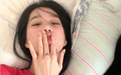 5 điều lưỡi có thể tiết lộ về sức khỏe: Từ ung thư đến nguy cơ đột quỵ cũng hiện ra!