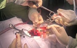 Liệt tứ chi vì một bất cẩn nhỏ