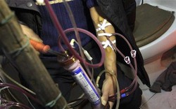 Nam kỹ sư 26 tuổi đột ngột phát hiện suy thận giai đoạn 4 kể: "Tôi chỉ đi khám đau ngón chân thôi mà!"