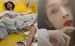 Nữ Tiktoker 27 tuổi qua đời vì chứng teo dạ dày, lúc cuối đời chỉ còn 17,5 kg: Mọi chuyện bắt đầu từ hoàn cảnh gia đình