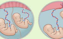 Bé trai nặng chưa đầy 1 kg được cứu sống thần kỳ