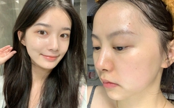 5 lọ serum đêm kích hoạt "công tác trẻ hóa làn da", tái tạo collagen ngay trong giấc ngủ