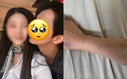 Công bố kết quả điều tra vụ nam diễn viên ngoan hiền bị tố đánh đập, “đào mỏ” bạn gái hàng trăm triệu
