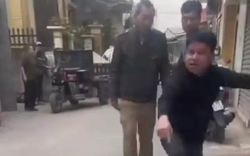 Hà Nội: Xác minh thông tin thả chó cắn vào mặt, chân người phụ nữ đi đường