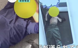 Khoảng trống hỗ trợ lao động nước ngoài sau vụ nam công nhân Việt bị đồng nghiệp người Nhật giẫm gãy xương sườn vì nghe điện thoại giữa giờ nghỉ trưa