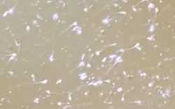 Lỗ hổng trong ngành thương mại tinh trùng tại châu Âu