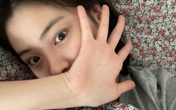 4 bất thường cho thấy cơ thể chị em tích tụ đầy độc tố, bác sĩ khuyên: Ăn 4 thứ và làm 3 việc