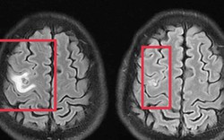 Người đàn ông 39 tuổi đau đầu, bác sĩ phát hiện thứ "đáng sợ" bên trong
