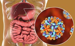 4 bệnh tưởng chừng lành tính nhưng có thể là tiền thân của ung thư