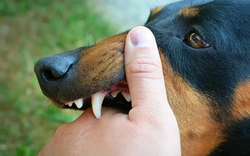 Người đàn ông 51 tuổi tử thương tâm sau khi bị chó "lạ" cắn