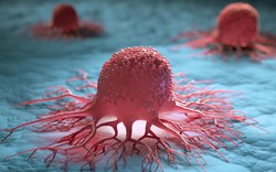 Nữ bác sĩ chiến thắng ung thư: “Ung thư không phải là nỗi sợ nếu bạn làm 4 điều này mỗi ngày”