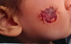 Bé gái 3 tuổi bị bỏng rộp cả mặt vì “miếng dán đồ chơi”: Nhiều đồ chơi hot trên mạng tuyệt đối không mua