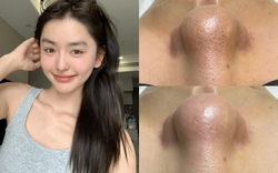 Loại mặt nạ giúp làm sạch sâu lỗ chân lông, nhưng khuyến cáo chỉ nên dùng 1 lần/tuần