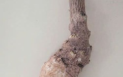 Cảnh báo ngộ độc, phản vệ nguy hiểm từ thực phẩm, rượu ngâm