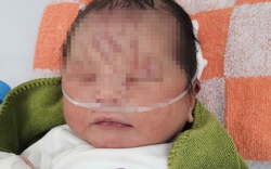 Bé sơ sinh bị vùi lấp ở Gia Lai chính thức được nhận nuôi