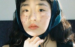 7 vị trí trên cơ thể thường chuyển sang MÀU ĐEN khi ung thư xuất hiện, tự kiểm tra ngay!