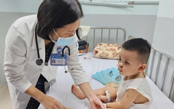 1 tuần TPHCM có hơn cả ngàn ca mắc tay chân miệng, Sở Y tế nói gì ?