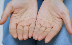 Nam giới mắc bệnh thận, thường xuyên ra mồ hôi ở 5 vị trí này