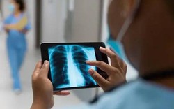 Những người có "phổi sạch" thường có 5 đặc điểm. Nếu bạn có 4 trong số đó, thì xin chúc mừng!